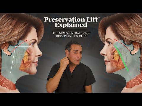 5 Celebrity Facelifts: The Next Generation Preservation Deep Plane Becoming Top Discussion